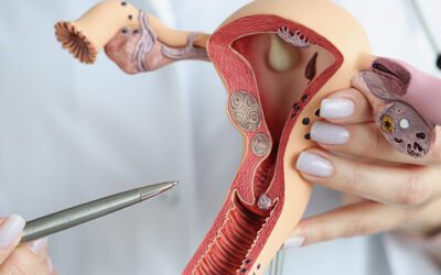 Hablemos de la endometriosis: ¿Qué es y cómo te afecta?